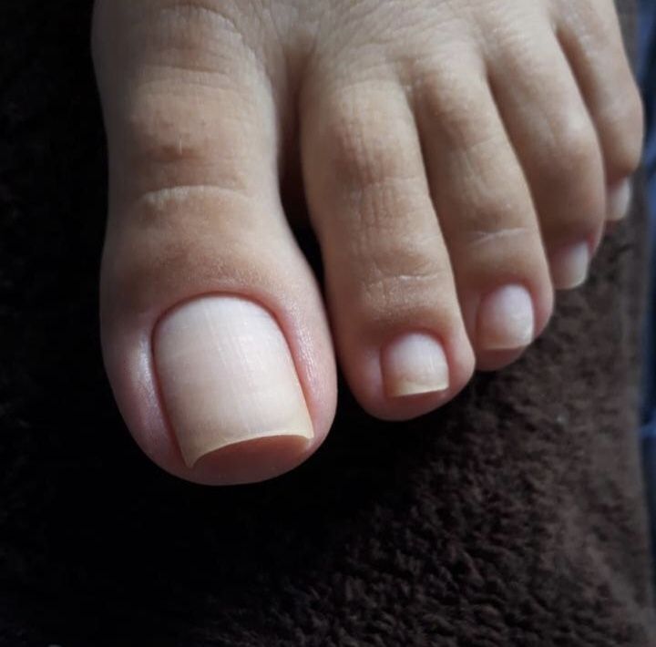 Dépose capsules pieds